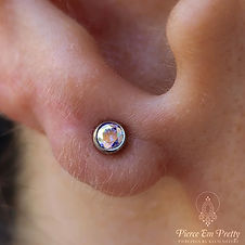 Microtia Earlobe w/ Neometal Jewelry