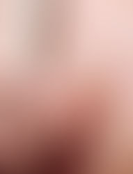 Dispositivo intrauterino: conheça melhor os tipos de DIU 