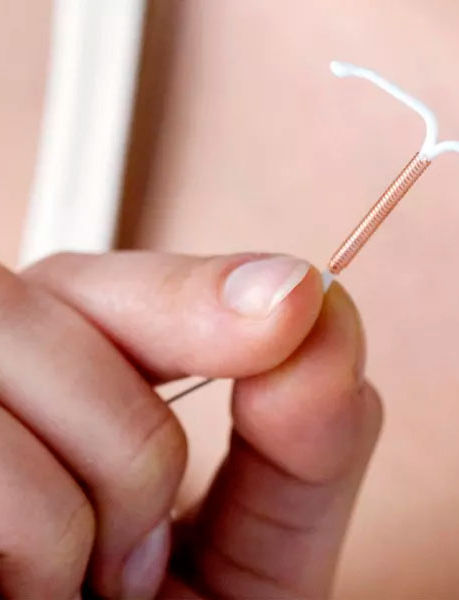 Dispositivo intrauterino: conheça melhor os tipos de DIU 