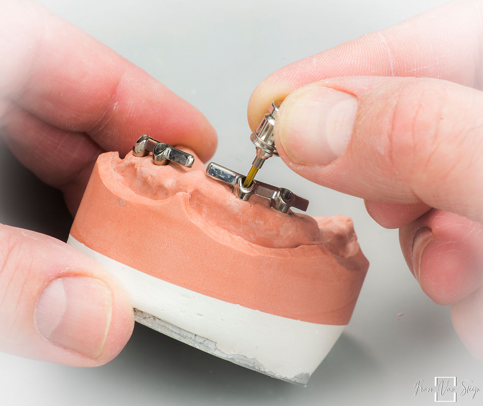 Implantaten-1