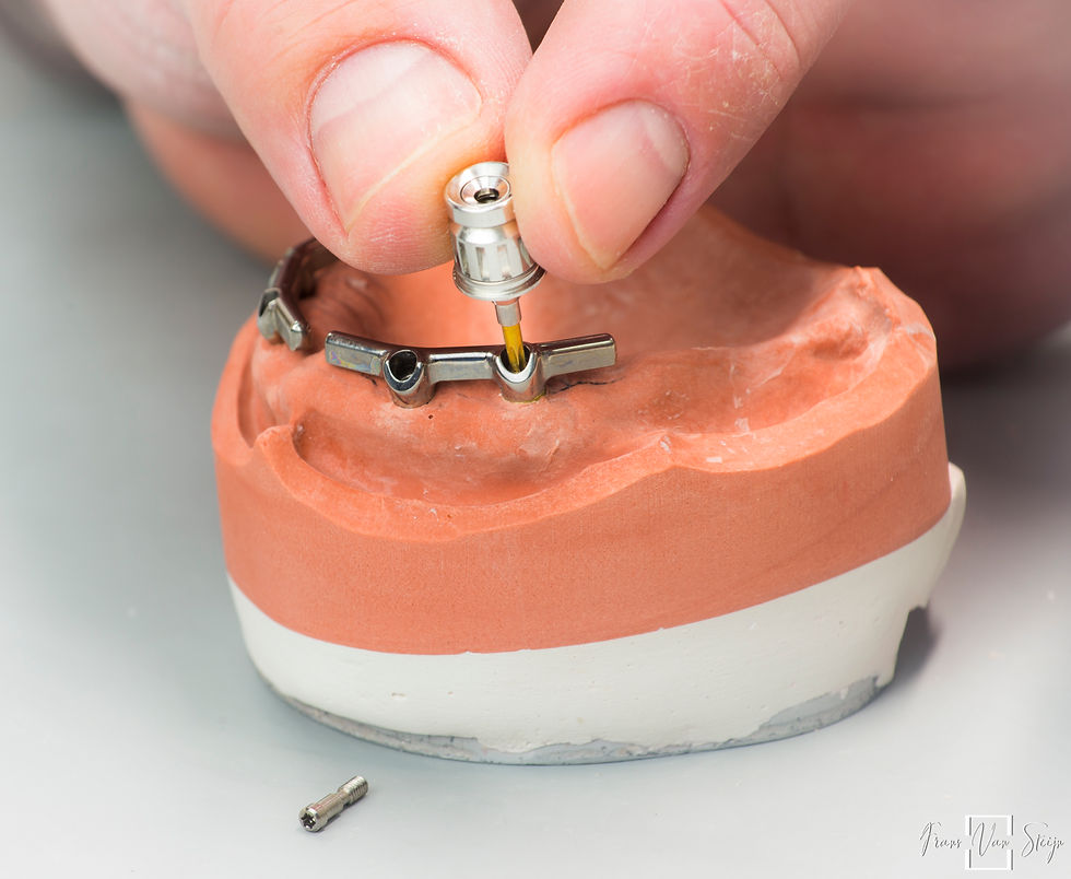 Implantaten-2