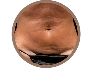ROND AP corps Temps.png
