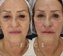 FULL-FACE1_edited.jpg