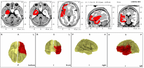 Neurofeedback