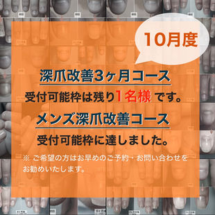 10月度の深爪改善コース受付可能枠について