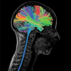 Innovación Tecnológica en Neurocirugía