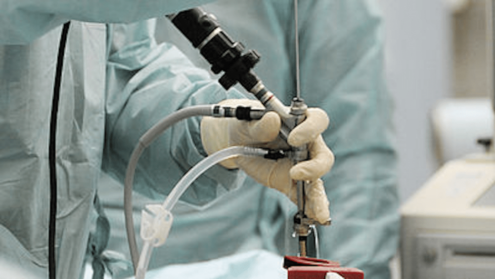 Endoscopio