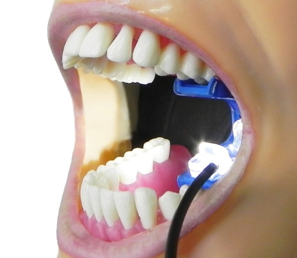 What Your Patients Will Love Most About Our Mouth Prop System