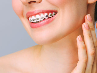 The Truth About How Orthodontics Can Change Your Face