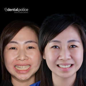 BEAUTY SMILE IS NOT ABOUT BEING WHITE TEETH✨