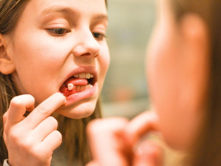 Apa Penyebab Gigi Copot dan Bagaimana Cara Mengatasinya?