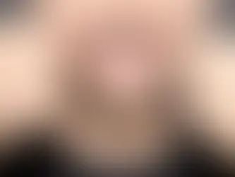 Bahaya Produk Pemutih Gigi Rumahan yang Perlu Diwaspadai