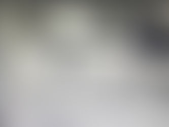 CABUT GIGI BUNGSU, BERAPA LAMA SAMPAI SAKITNYA HILANG DAN SEMBUH?