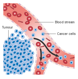 A diagram showing tumour cells invading the blood stream and developing into cancer cells
