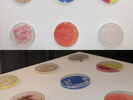 Petri Dishes by Eli C.