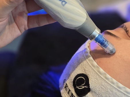 Microneedling