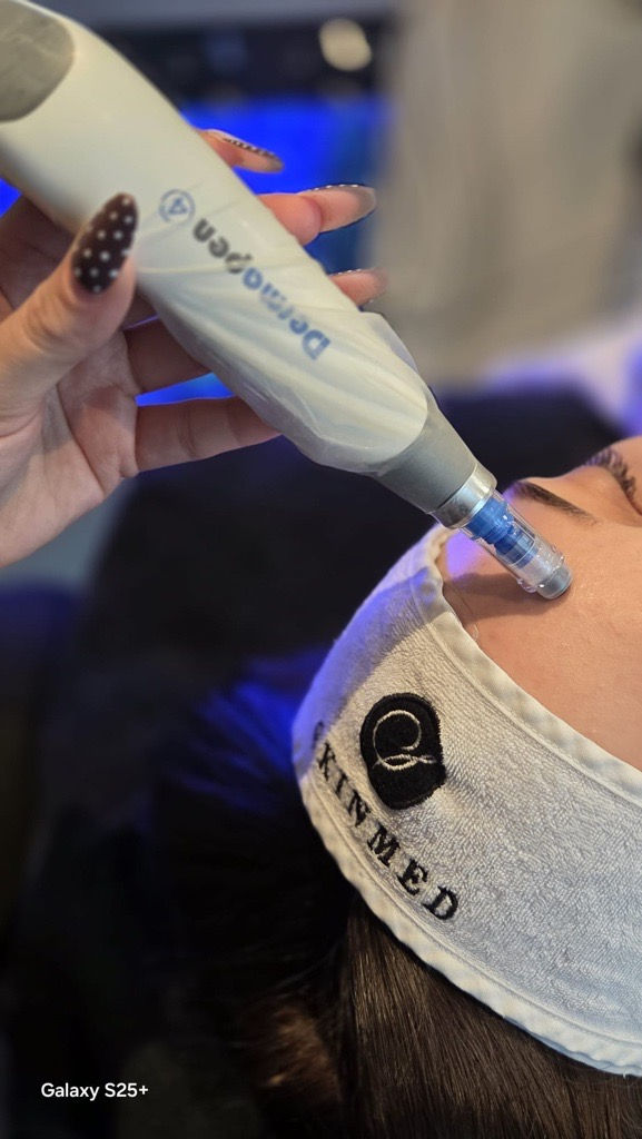 Microneedling