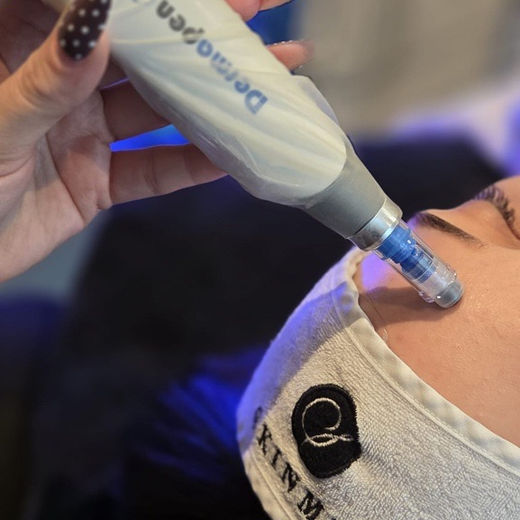 Dermapen