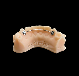 Prothésiste dentaire Le Mans spécialiste Orthodontie ODF