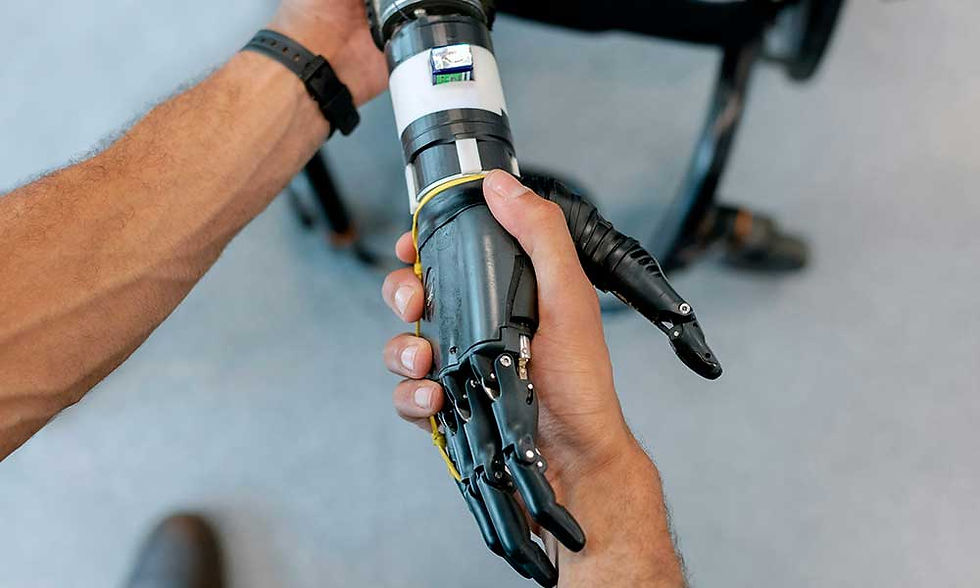 Une prothèse de bras