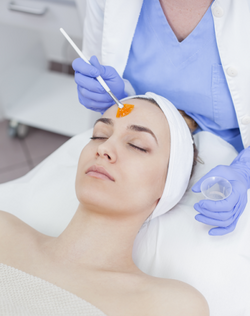Chemical Peels