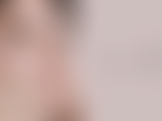 Acne in your 20s: causes + solutions