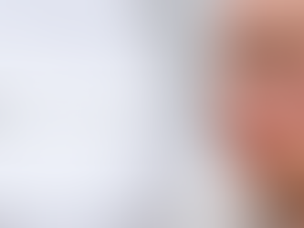 Acne in your teens: causes + solutions