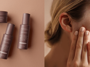 Benzoyl peroxide alternatives + how to clear your skin without harm