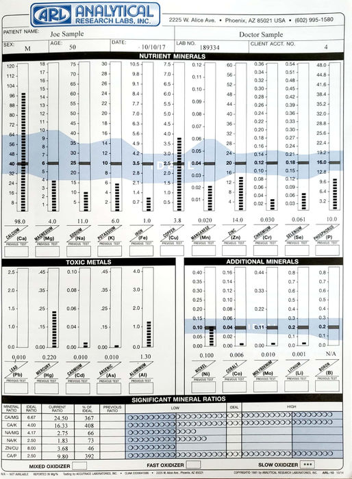 Check Your Mineral Levels With Testing