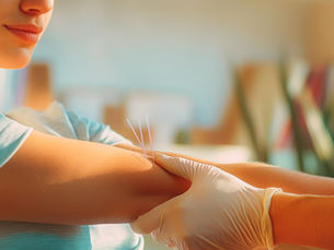 Benefits of Dry Needling for Pain and Performance