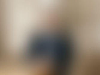 Professional man receiving preventative Botox treatment at Luxe Aesthetics Loft med spa in Langley BC