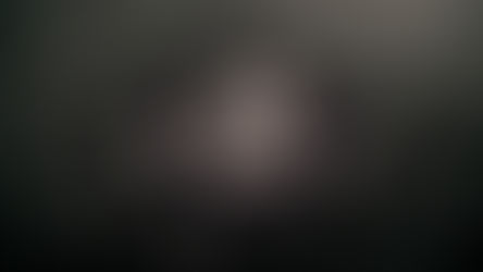 Otizm Spektrum Bozukluğu ve İmmünolojik Disfonksiyon