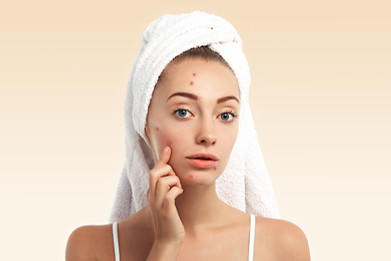 closeup-young-woman-with-towel-head-pimples-face.jpg