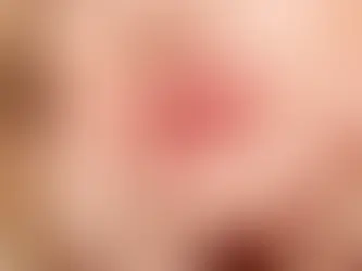Jak powiększyć usta?