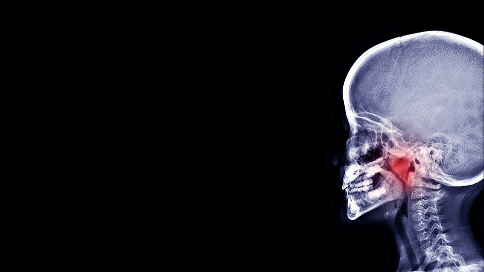adenoids adenoidectomy
