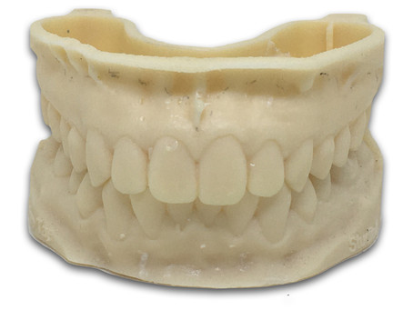 Diagnóstico, escaneamento, softwares e manufatura – onde está dentista do esporte no fluxo digital?