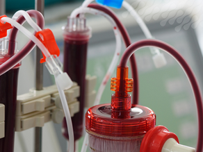 Comprendiendo la enfermedad renal crónica: cuidando de nuestros seres queridos
