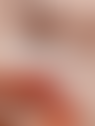 mettre de la ouate dans l'oreille