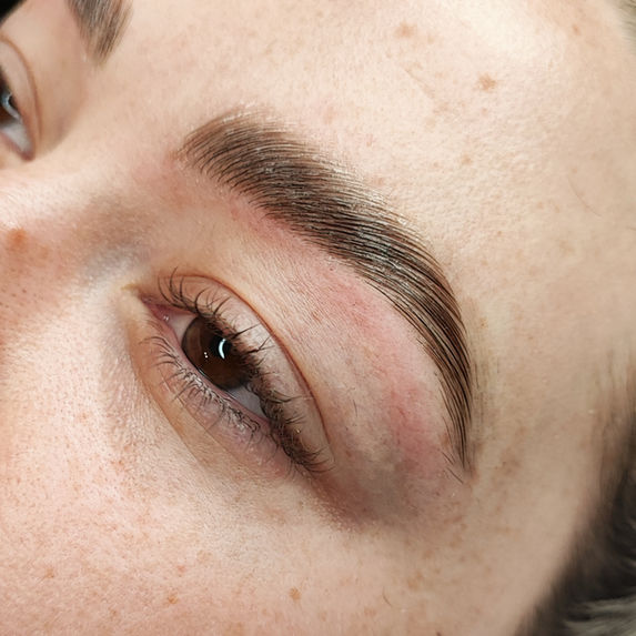 Auf diesem Foto ist ein  Augenbrauenlifting zu sehen.