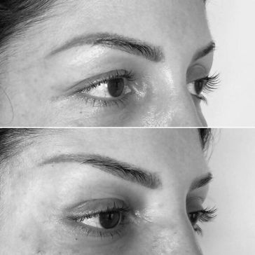 FOX EYE LIFT