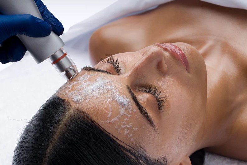 Thumbnail: BT Aquafuse Tech Peel