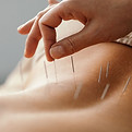 4767-acupuncture.jpg