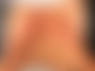 Do you need an osteopath London for Chronic Fatigue? Visit Rakhee Osteopathy for treatment using The Perrin Technique