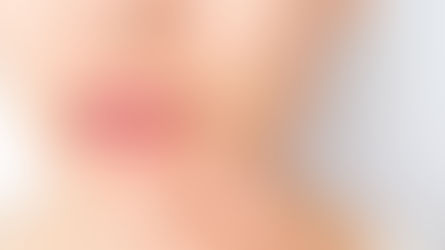 Adult Acne? Causes, Treatments & Prevention