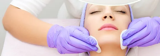 chemical-peel-img.webp