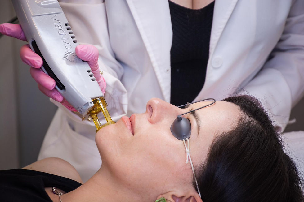 candela laser hair removal face palm beach gardens florida.jpg