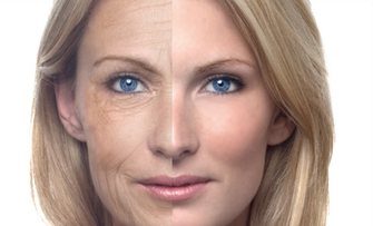 All You Need To Know About Microneedling
