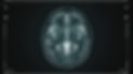 CNR-400s: Neurology | Canurta Therapeutics