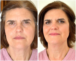 Antes_e_Depois_Mãe