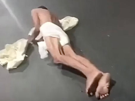 Homem despenca de ambulância em movimento no Túnel Santa Bárbara, no Rio